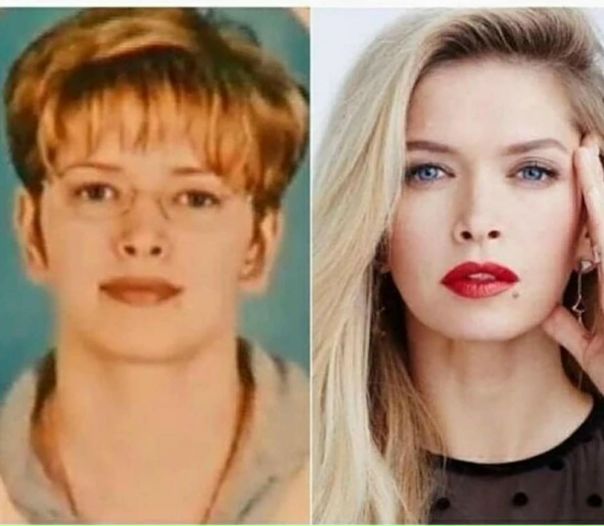 «Единственное, что делала, — уход у косметолога»: Вера Брежнева утверждает, что она не делала пластические операции