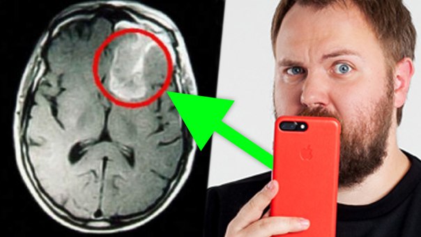Ученые доказали: Смартфон вызывает рак мозга!